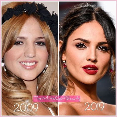 eiza gonzález lips before and after|eiza gonzález early life.